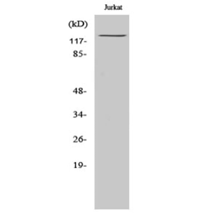 Western Blot - Anti-IFIH1 Antibody (C11646) - Antibodies.com