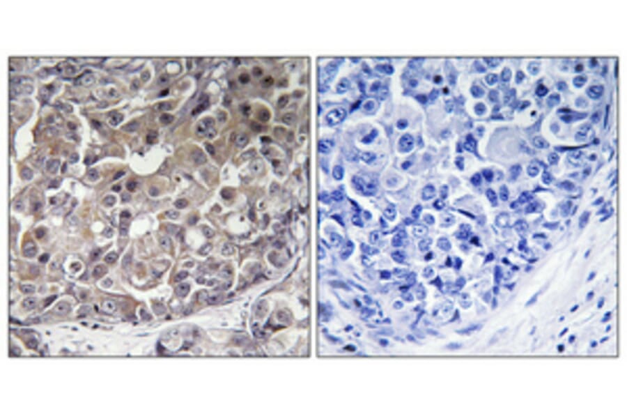 Immunohistochemistry - Anti-IFIH1 Antibody (C11646) - Antibodies.com