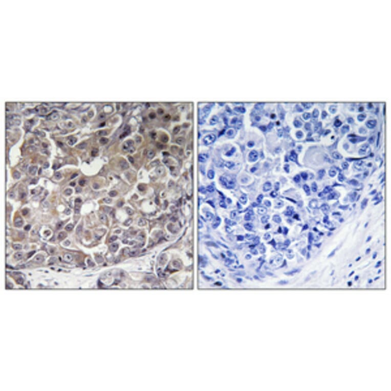 Immunohistochemistry - Anti-IFIH1 Antibody (C11646) - Antibodies.com