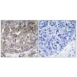 Immunohistochemistry - Anti-IFIH1 Antibody (C11646) - Antibodies.com