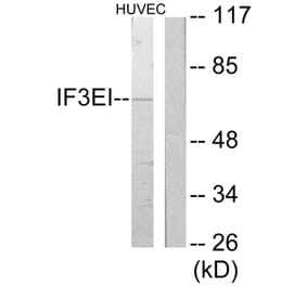 Western Blot - Anti-IF3EI Antibody (C11925) - Antibodies.com