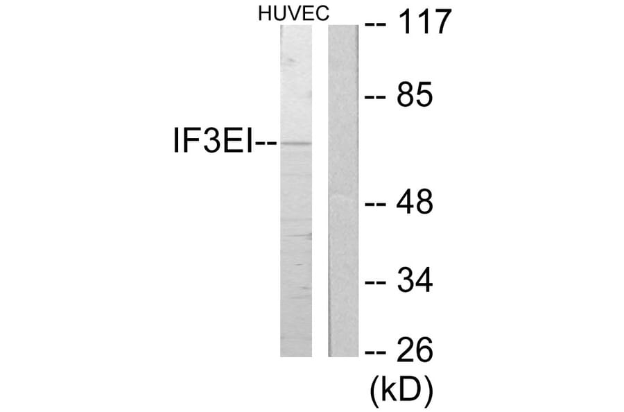 Western Blot - Anti-IF3EI Antibody (C11925) - Antibodies.com