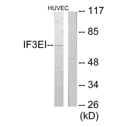 Western Blot - Anti-IF3EI Antibody (C11925) - Antibodies.com