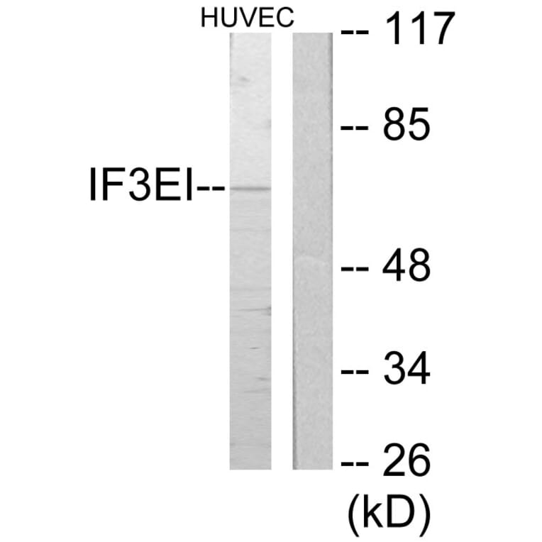 Western Blot - Anti-IF3EI Antibody (C11925) - Antibodies.com