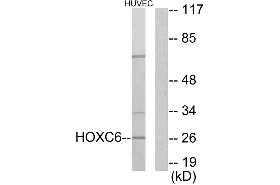 Western Blot - Anti-HOXC6 Antibody (C10318) - Antibodies.com