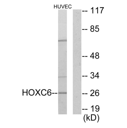 Western Blot - Anti-HOXC6 Antibody (C10318) - Antibodies.com