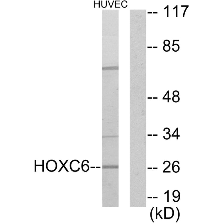 Western Blot - Anti-HOXC6 Antibody (C10318) - Antibodies.com