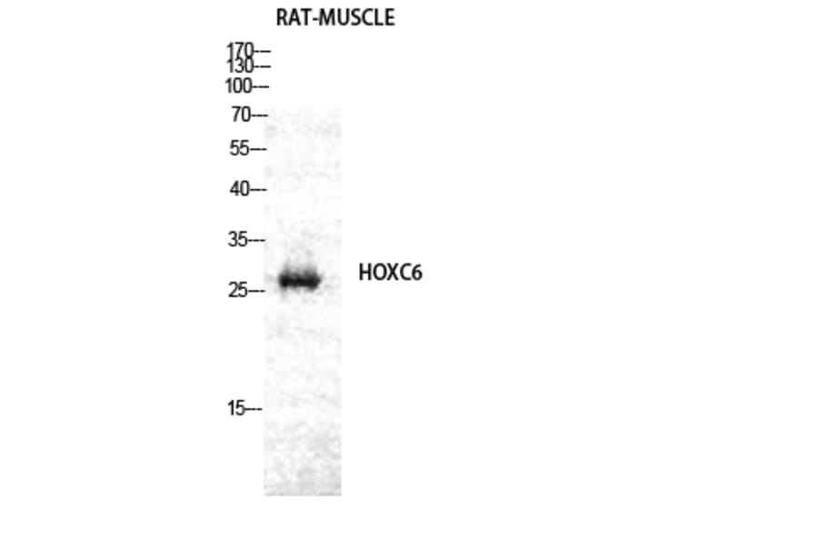 Western Blot - Anti-HOXC6 Antibody (C10318) - Antibodies.com