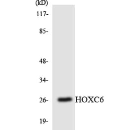 Western Blot - Anti-HOXC6 Antibody (R12-2891) - Antibodies.com