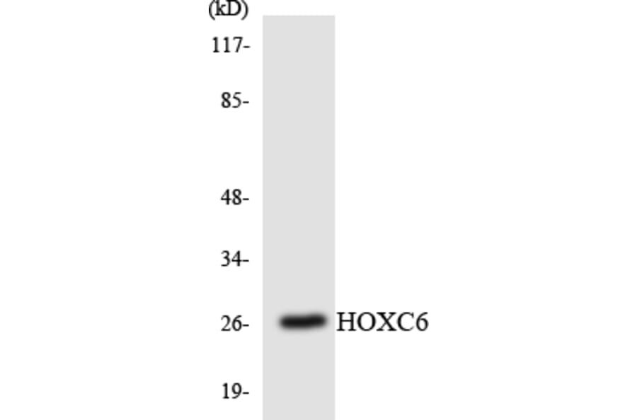 Western Blot - Anti-HOXC6 Antibody (R12-2891) - Antibodies.com