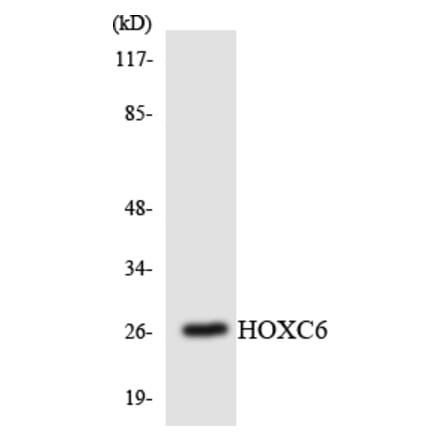 Western Blot - Anti-HOXC6 Antibody (R12-2891) - Antibodies.com