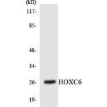 Western Blot - Anti-HOXC6 Antibody (R12-2891) - Antibodies.com