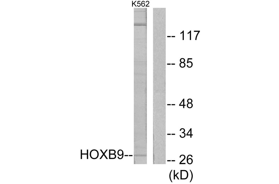 Western Blot - Anti-HOXB9 Antibody (C10404) - Antibodies.com