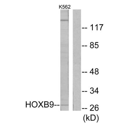 Western Blot - Anti-HOXB9 Antibody (C10404) - Antibodies.com