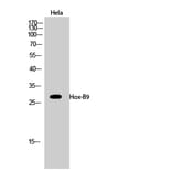 Western Blot - Anti-HOXB9 Antibody (C10404) - Antibodies.com