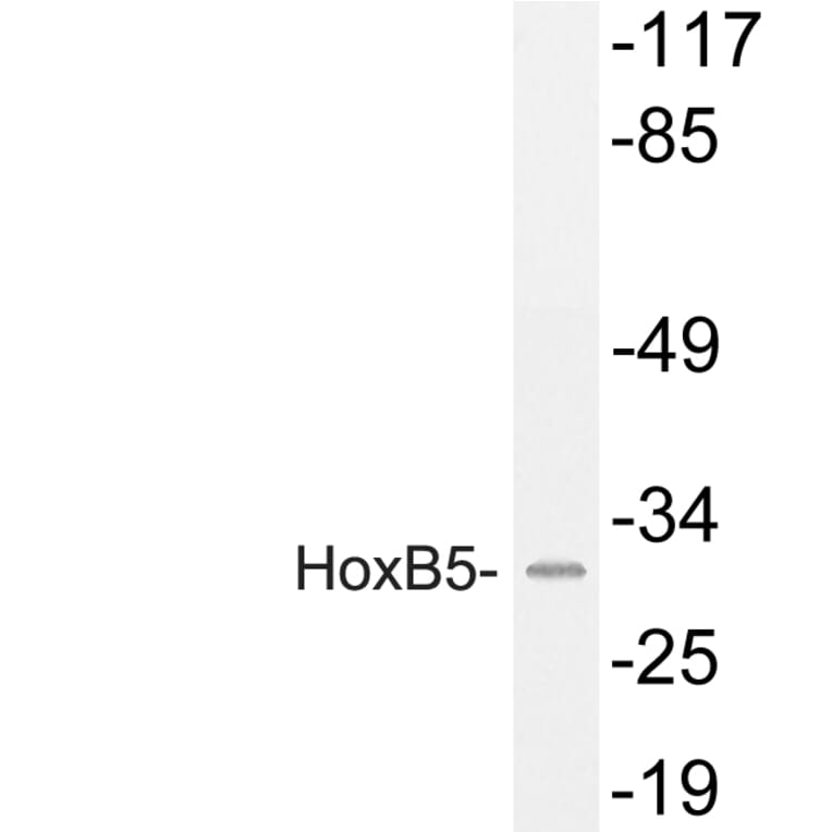 Western Blot - Anti-HoxB5 Antibody (R12-2186) - Antibodies.com