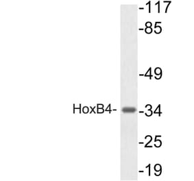 Western Blot - Anti-HoxB4 Antibody (R12-2185) - Antibodies.com