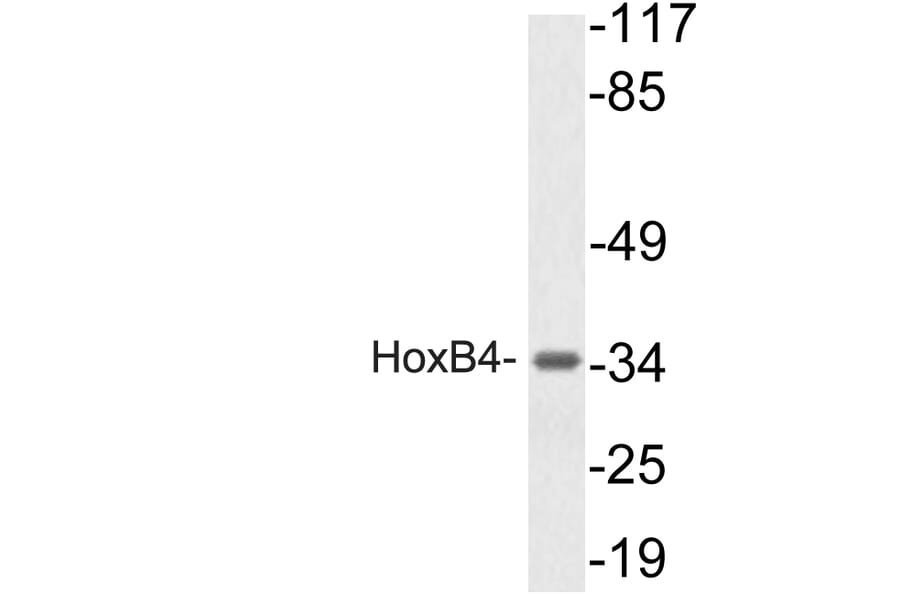Western Blot - Anti-HoxB4 Antibody (R12-2185) - Antibodies.com