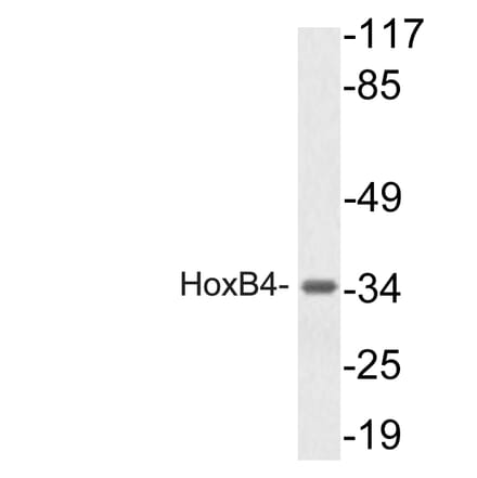 Western Blot - Anti-HoxB4 Antibody (R12-2185) - Antibodies.com