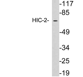 Western Blot - Anti-HIC-2 Antibody (R12-2179) - Antibodies.com