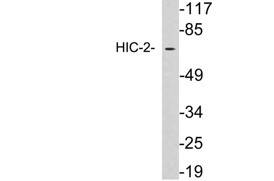 Western Blot - Anti-HIC-2 Antibody (R12-2179) - Antibodies.com