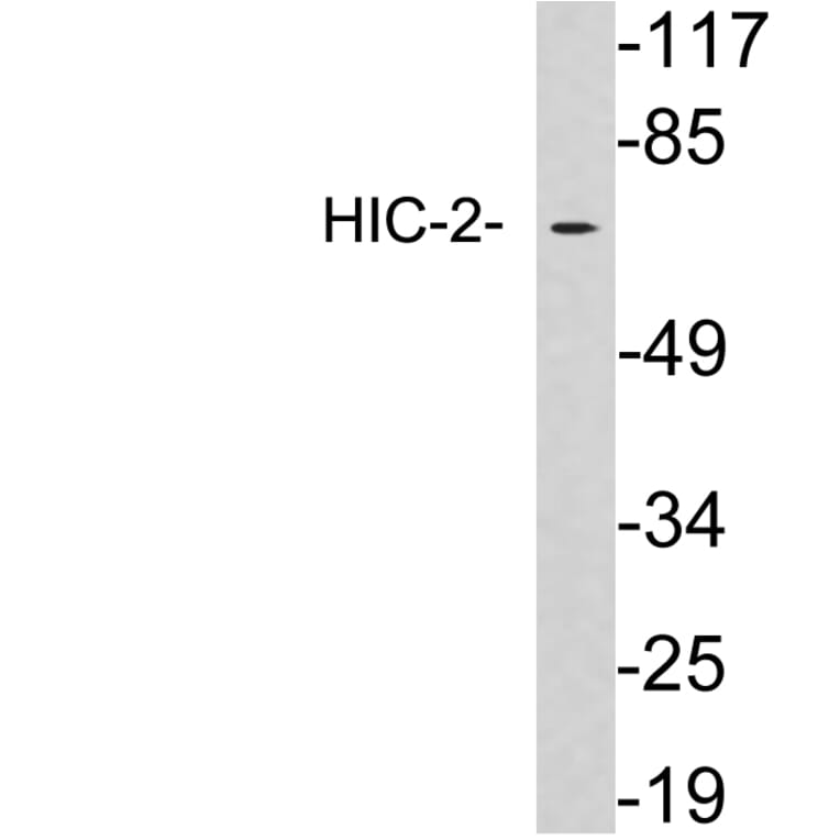Western Blot - Anti-HIC-2 Antibody (R12-2179) - Antibodies.com