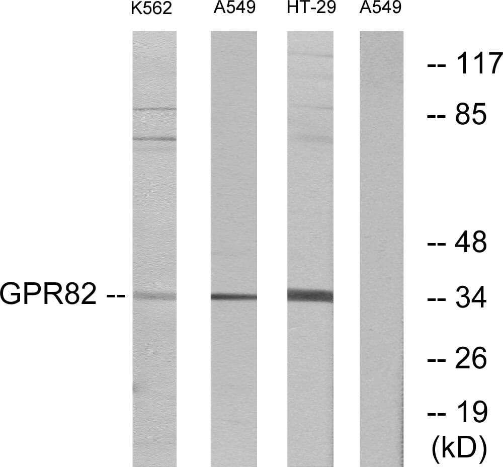 Western blot analysis of lysates from A549, K56 and HT-29 cells using Anti-GPR82 Antibody. The right hand lane represents a negative control, where the antibody is blocked by the immunising peptide.