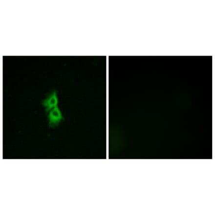 Immunofluorescence - Anti-GPR22 Antibody (G330) - Antibodies.com