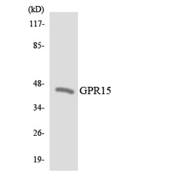 Western Blot - Anti-GPR15 Antibody (R12-2832) - Antibodies.com