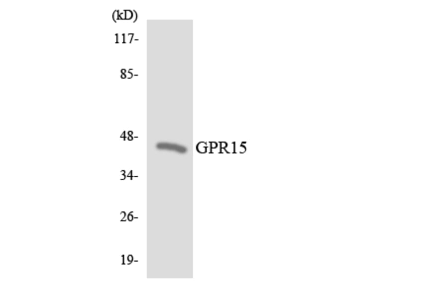 Western Blot - Anti-GPR15 Antibody (R12-2832) - Antibodies.com