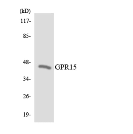 Western Blot - Anti-GPR15 Antibody (R12-2832) - Antibodies.com