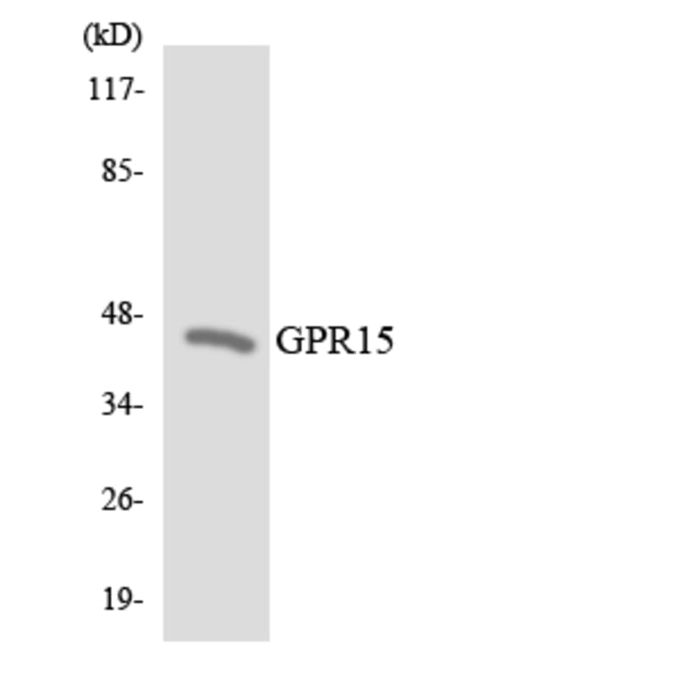 Western Blot - Anti-GPR15 Antibody (R12-2832) - Antibodies.com