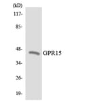 Western Blot - Anti-GPR15 Antibody (R12-2832) - Antibodies.com