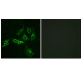 Immunofluorescence - Anti-GNRHR Antibody (G276) - Antibodies.com