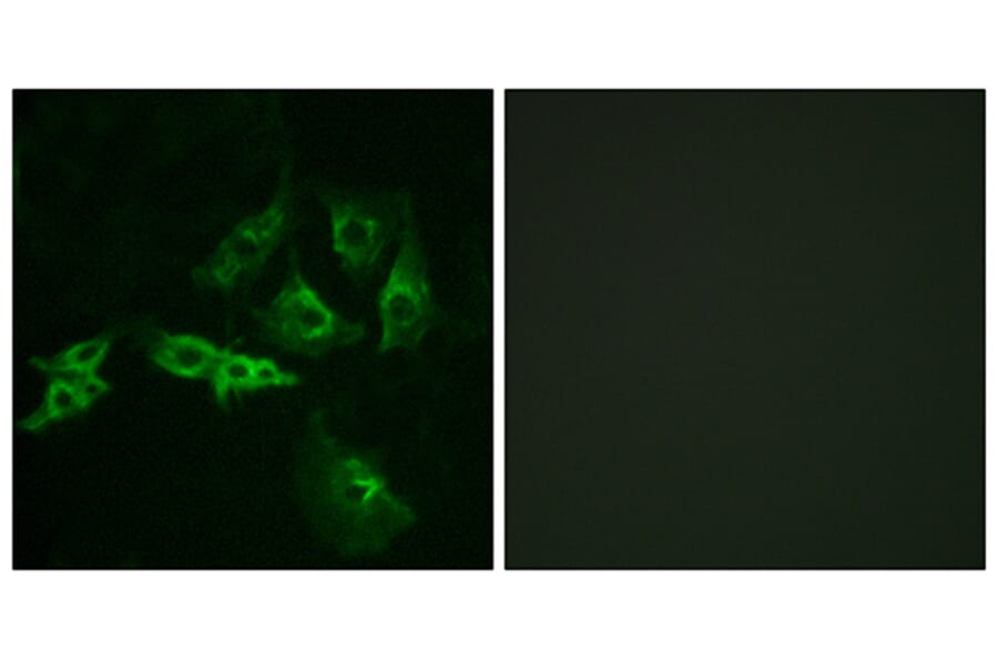 Immunofluorescence - Anti-GNRHR Antibody (G276) - Antibodies.com