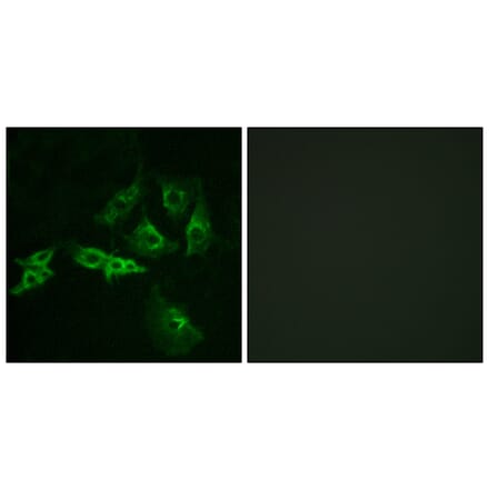 Immunofluorescence - Anti-GNRHR Antibody (G276) - Antibodies.com