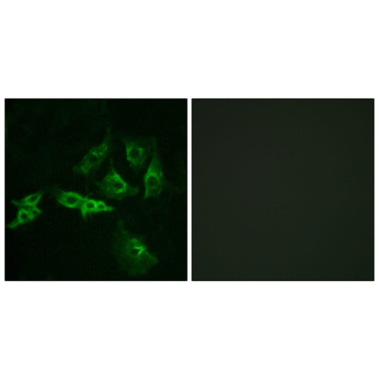 Immunofluorescence - Anti-GNRHR Antibody (G276) - Antibodies.com