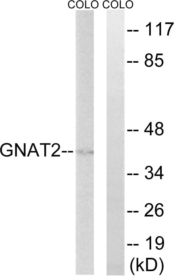Western blot analysis of lysates from COLO cells using Anti-GNAT2 Antibody. The right hand lane represents a negative control, where the antibody is blocked by the immunising peptide.