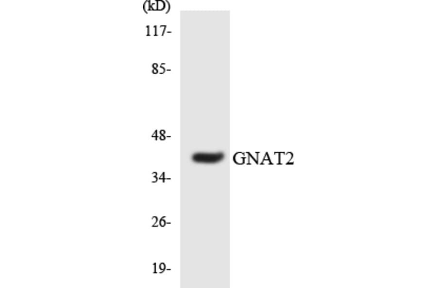 Western Blot - Anti-GNAT2 Antibody (R12-2818) - Antibodies.com