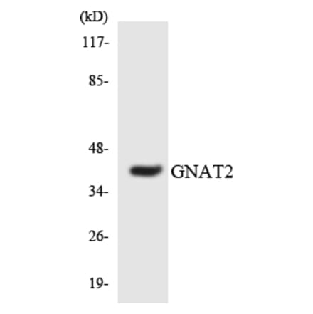 Western Blot - Anti-GNAT2 Antibody (R12-2818) - Antibodies.com