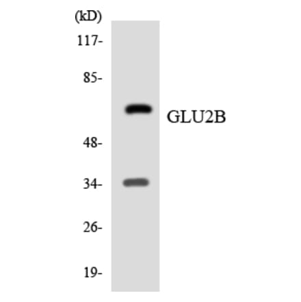 Western Blot - Anti-GLU2B Antibody (R12-2817) - Antibodies.com