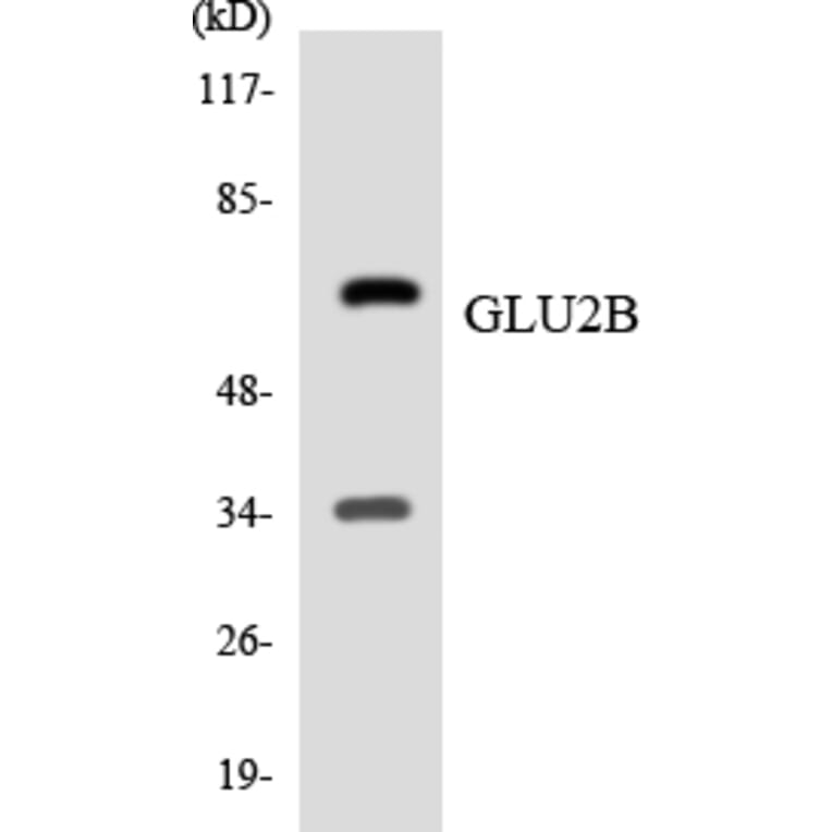 Western Blot - Anti-GLU2B Antibody (R12-2817) - Antibodies.com