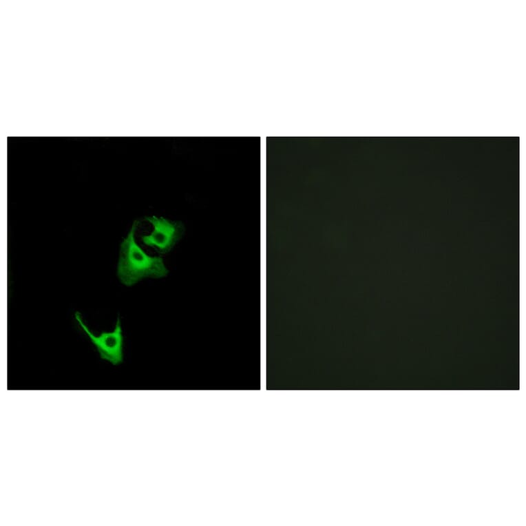 Immunofluorescence - Anti-GLP1R Antibody (G273) - Antibodies.com