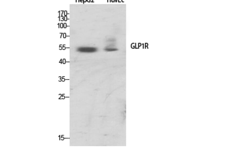 Western Blot - Anti-GLP1R Antibody (G273) - Antibodies.com
