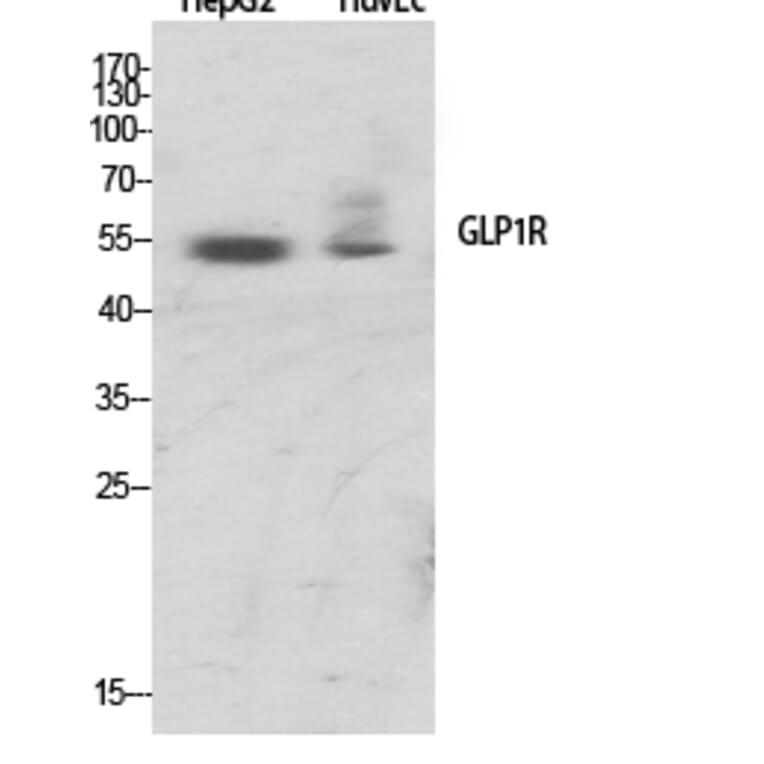 Western Blot - Anti-GLP1R Antibody (G273) - Antibodies.com