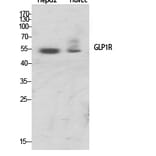 Western Blot - Anti-GLP1R Antibody (G273) - Antibodies.com
