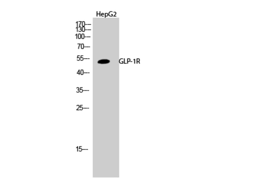 Western Blot - Anti-GLP1R Antibody (G273) - Antibodies.com