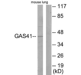 Western Blot - Anti-GAS41 Antibody (C10237) - Antibodies.com