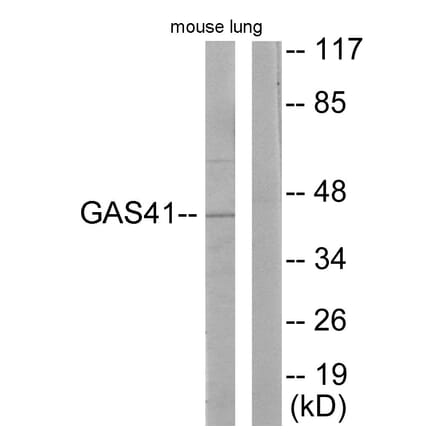 Western Blot - Anti-GAS41 Antibody (C10237) - Antibodies.com