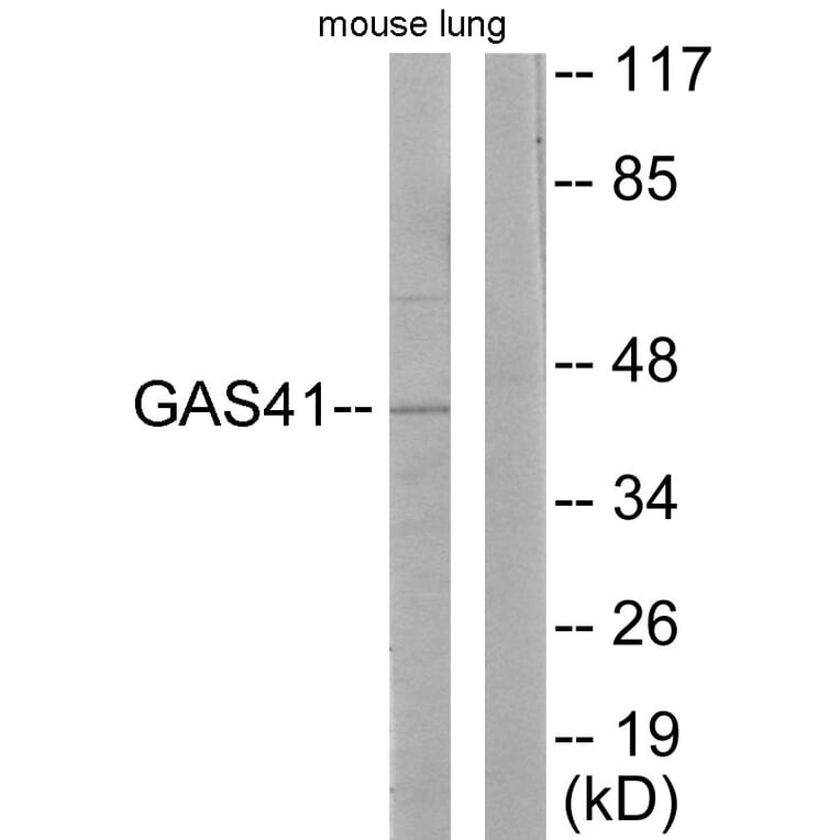 Western Blot - Anti-GAS41 Antibody (C10237) - Antibodies.com